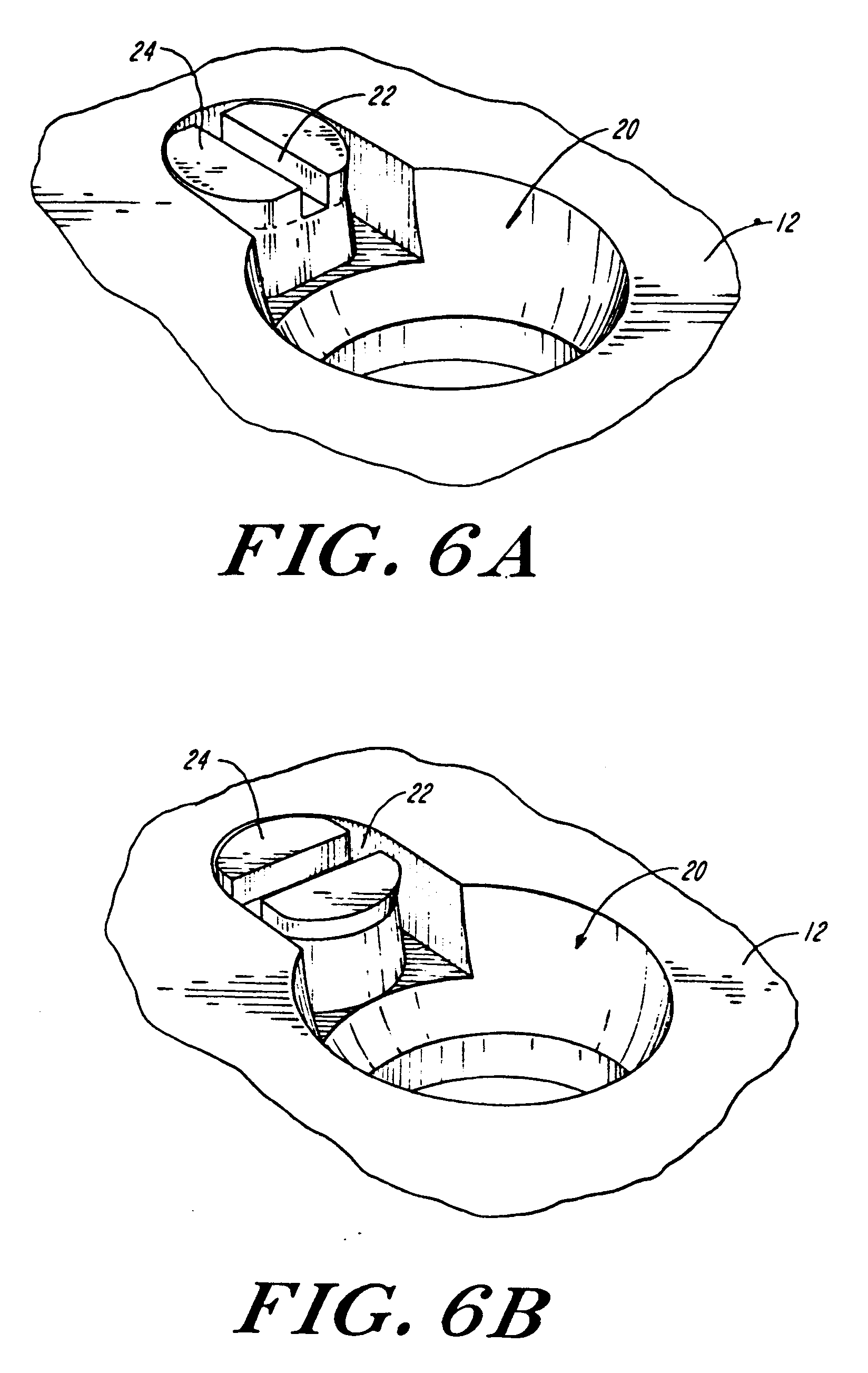 osteosynthesis screws osteosynthesis screws