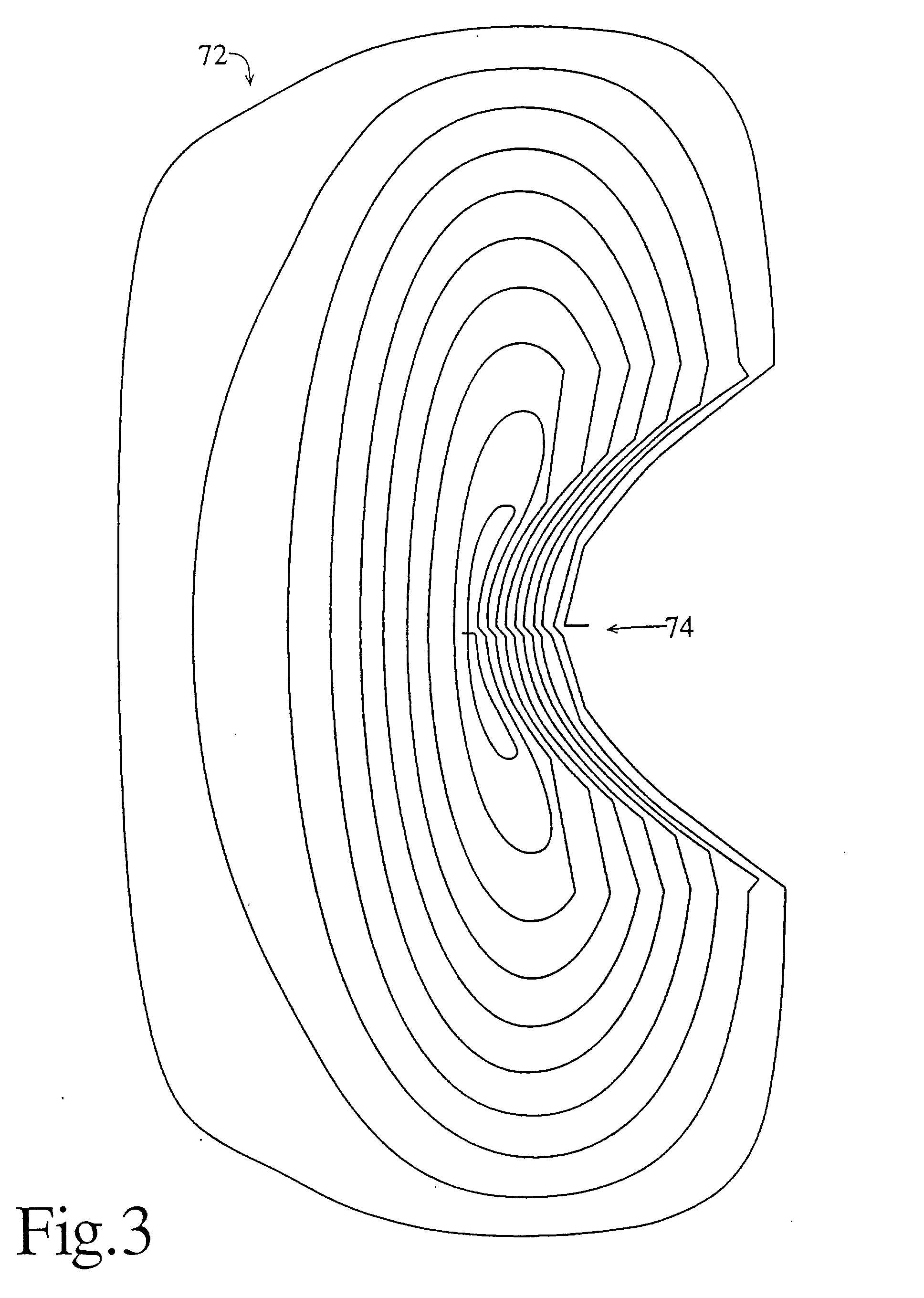 an introduction to the marconi medical systems magnetic resonance Abstract of ep0580327 a magnetic resonance apparatus includes a magnet (10) which generates a uniform, static magnetic field through a. an introduction to the marconi medical systems magnetic resonance Abstract of ep0580327 a magnetic resonance apparatus includes a magnet (10) which generates a uniform, static magnetic field through a.