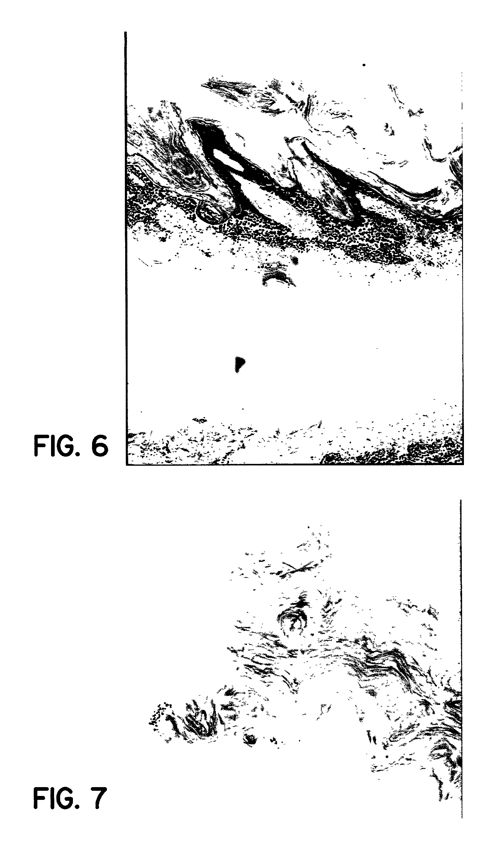 Levitra with dapoxetine