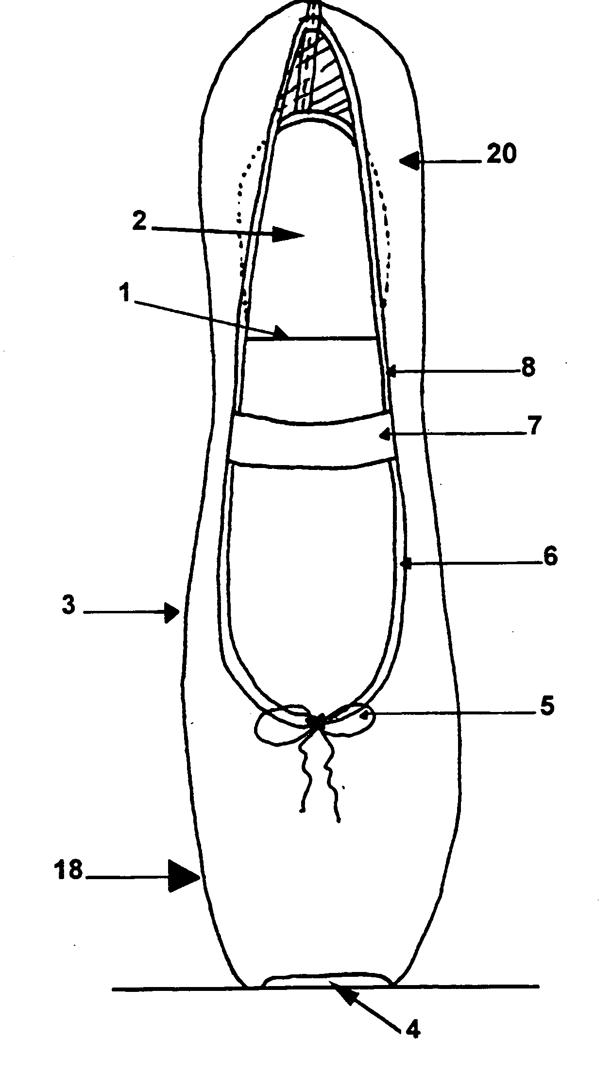 Hammertoe