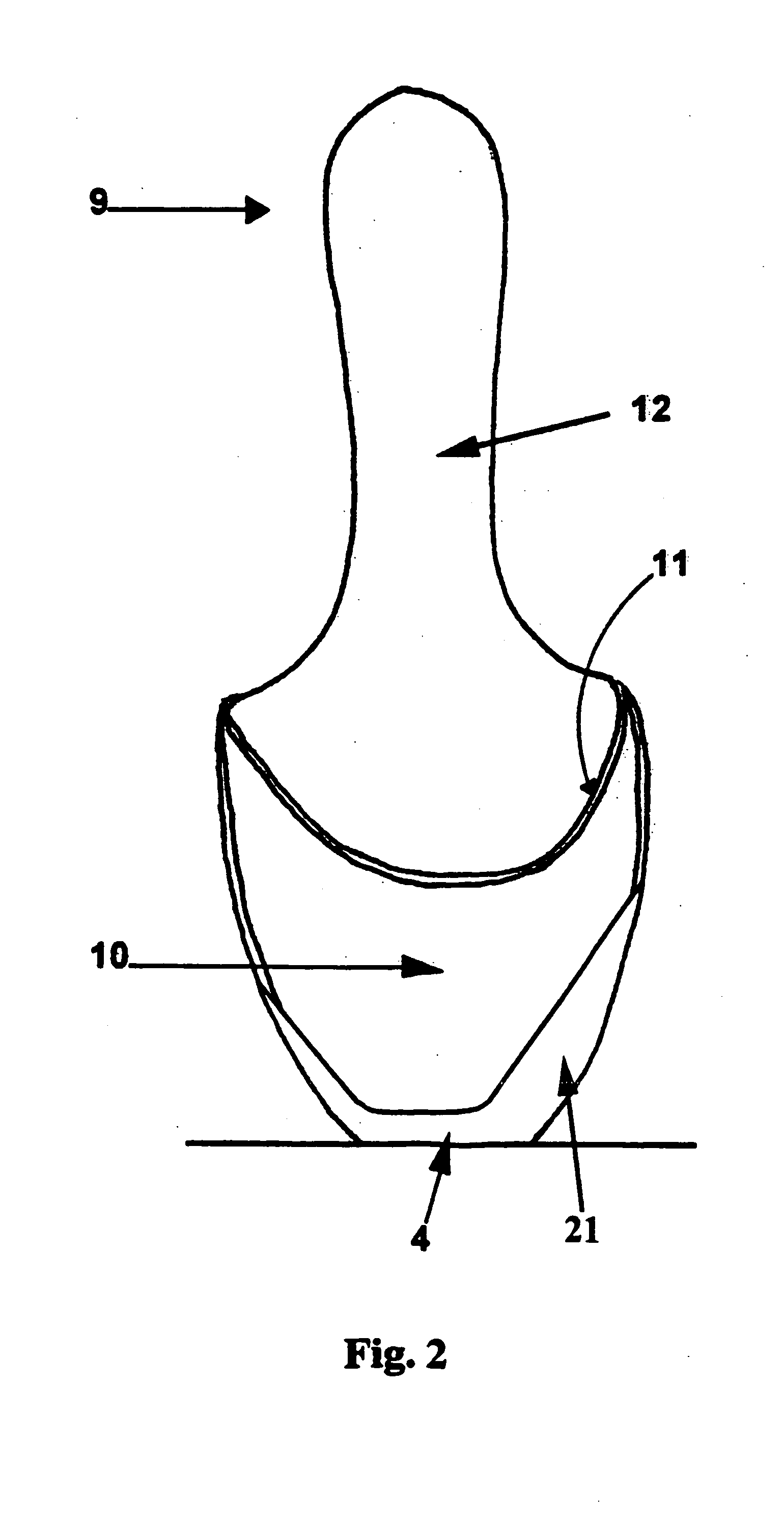 Hammer Toe