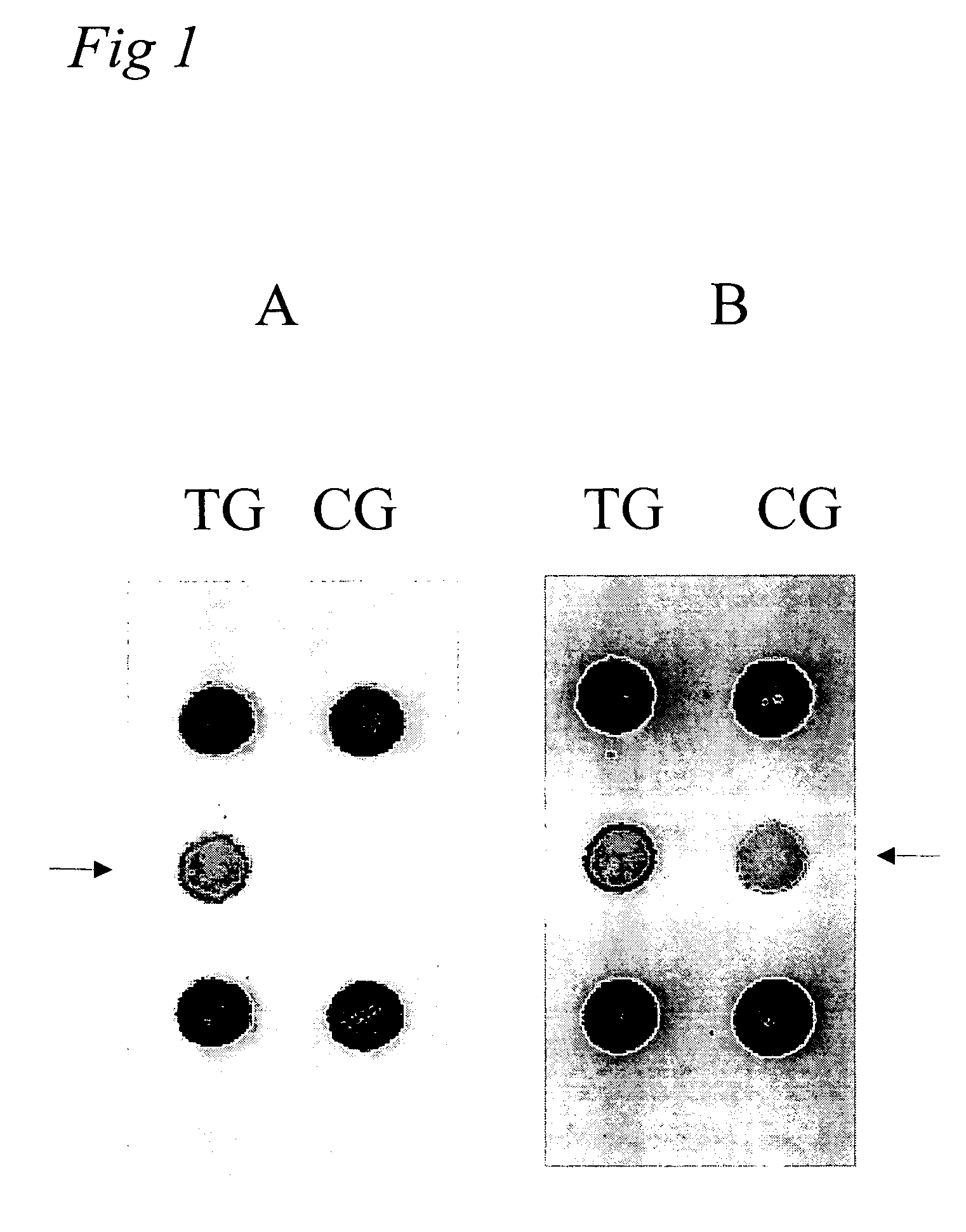 genetic disorder assignment colon cancer Genetic polymorphisms of scn9a are associated with oxaliplatin-induced neuropathy detection and allele assignment neuropathy in colon cancer. genetic disorder assignment colon cancer Genetic polymorphisms of scn9a are associated with oxaliplatin-induced neuropathy detection and allele assignment neuropathy in colon cancer.