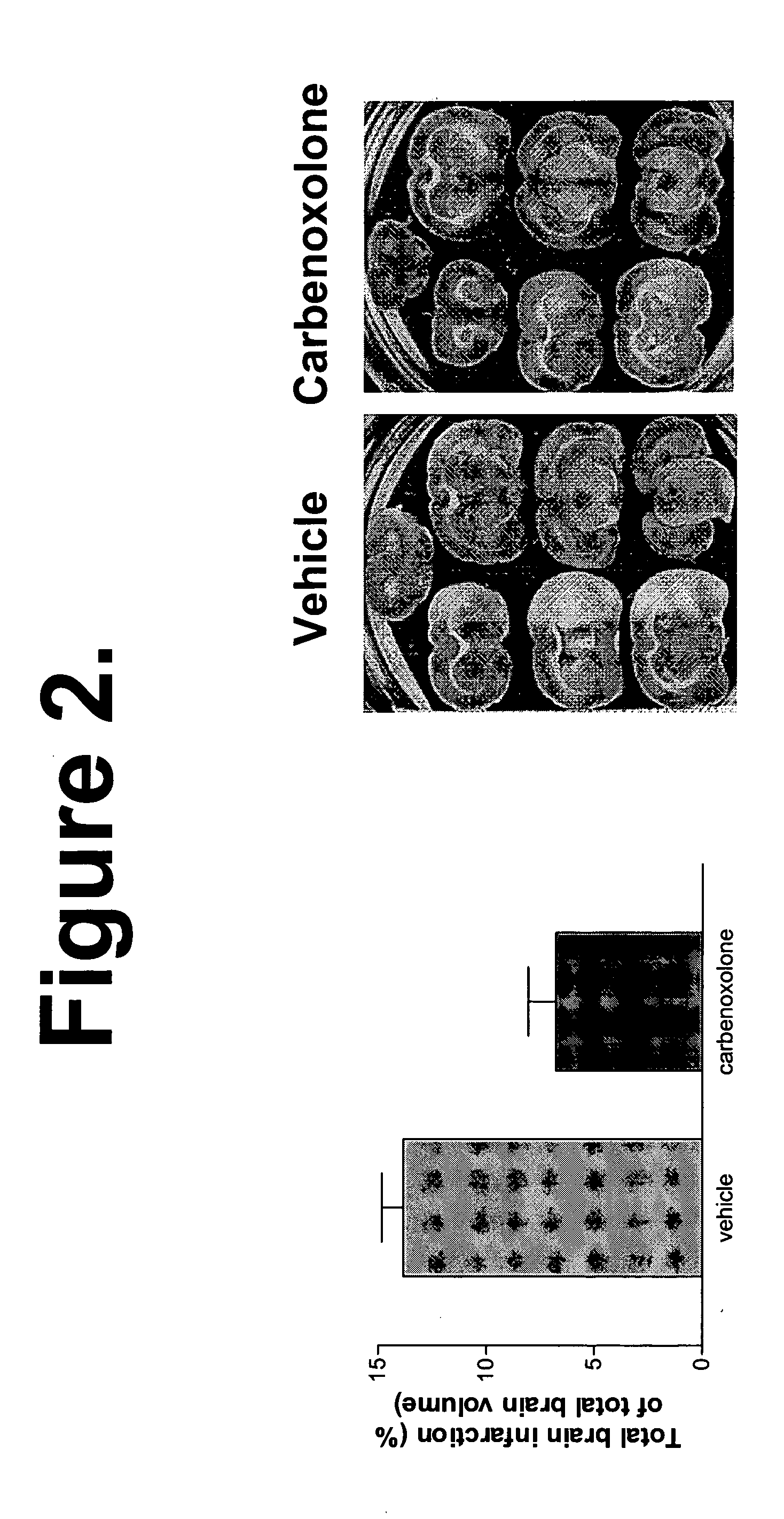 neurologic disorder Neurological disease and disorder news and features content for medical professionals drug monographs for dementia, alzheimer's and other neurodegenerative disorders. neurologic disorder Neurological disease and disorder news and features content for medical professionals drug monographs for dementia, alzheimer's and other neurodegenerative disorders.