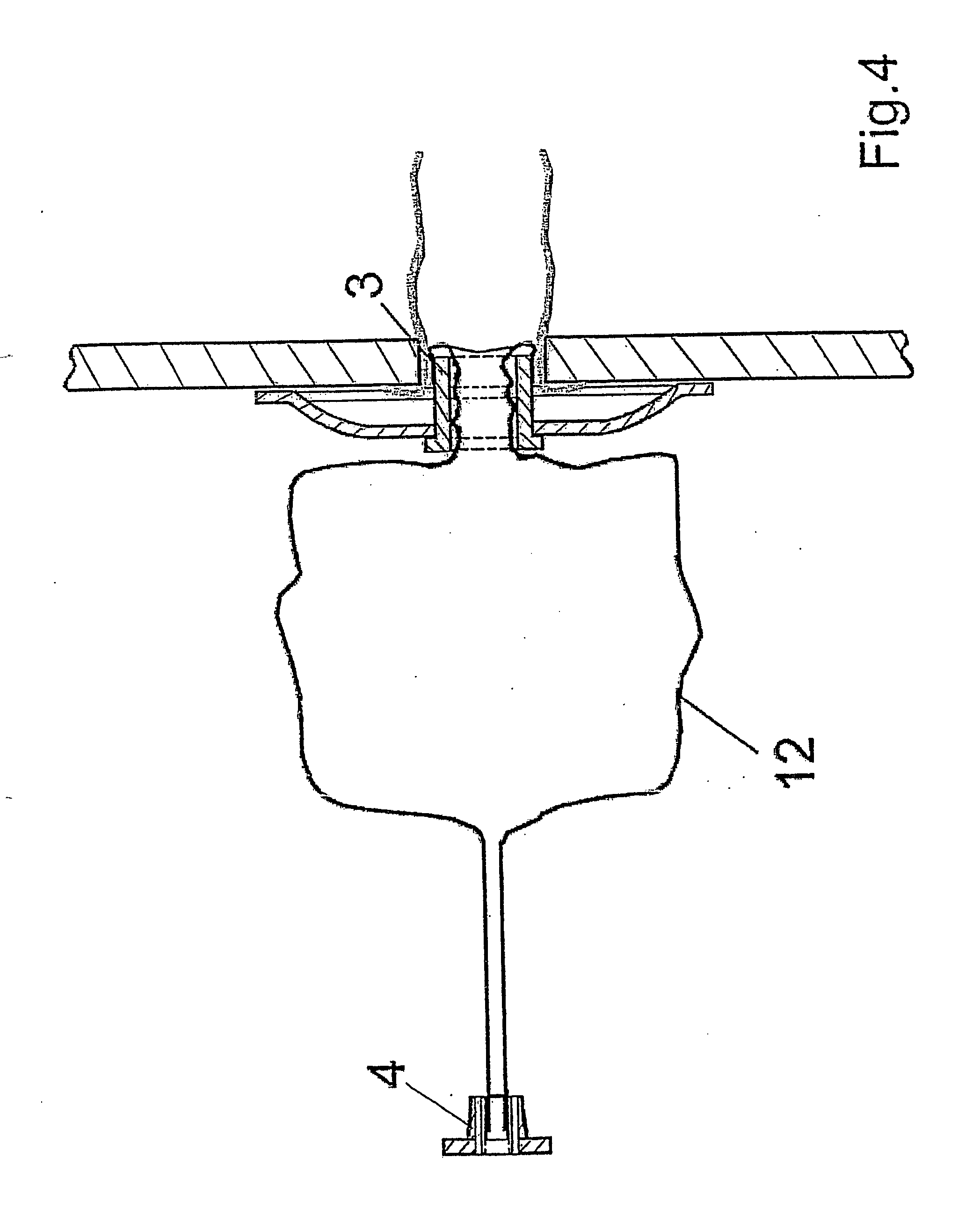 All does Define patent anus valuable piece Define patent anus apologise