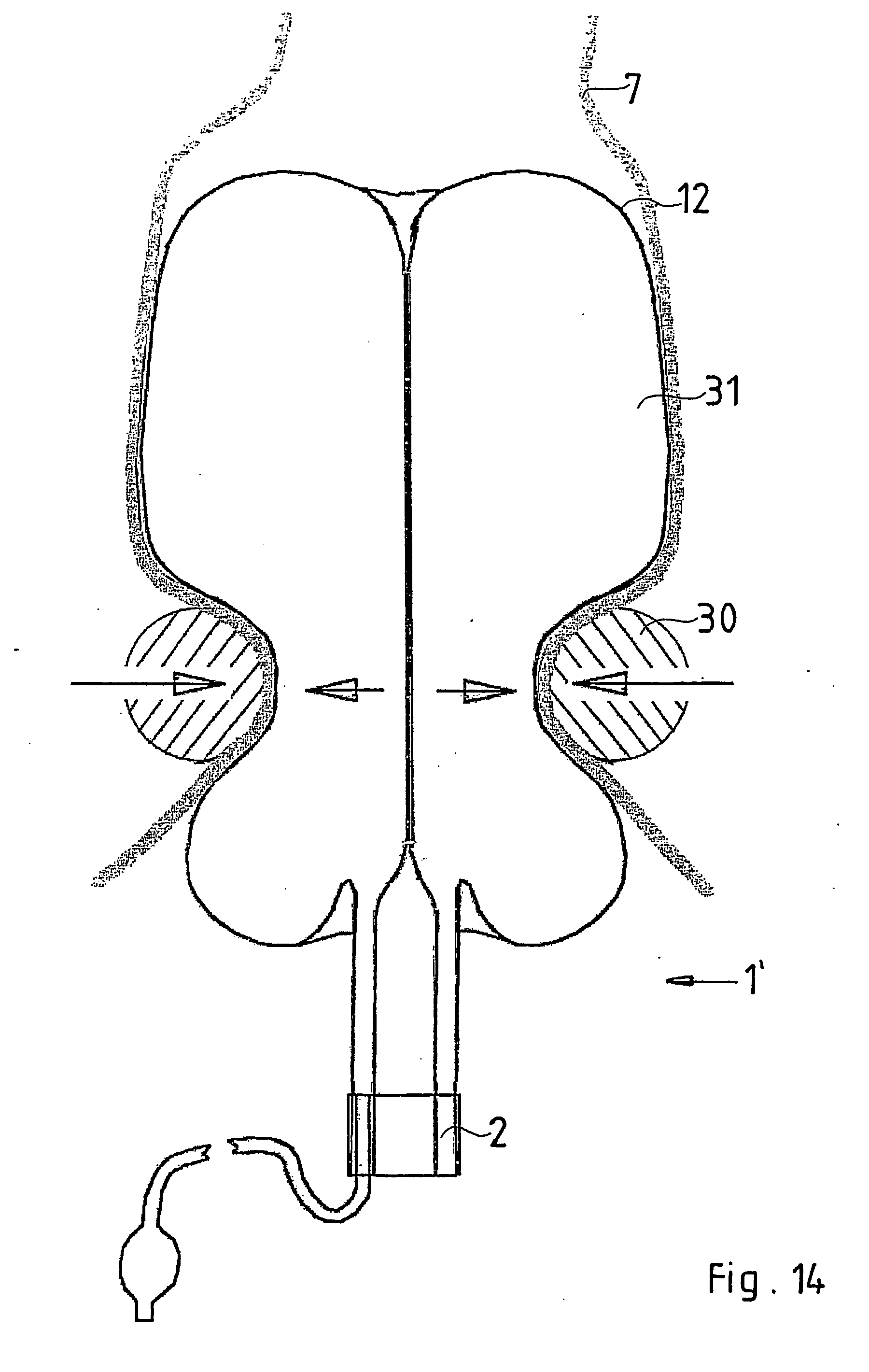 Matchless Define patent anus authoritative message Define patent anus are