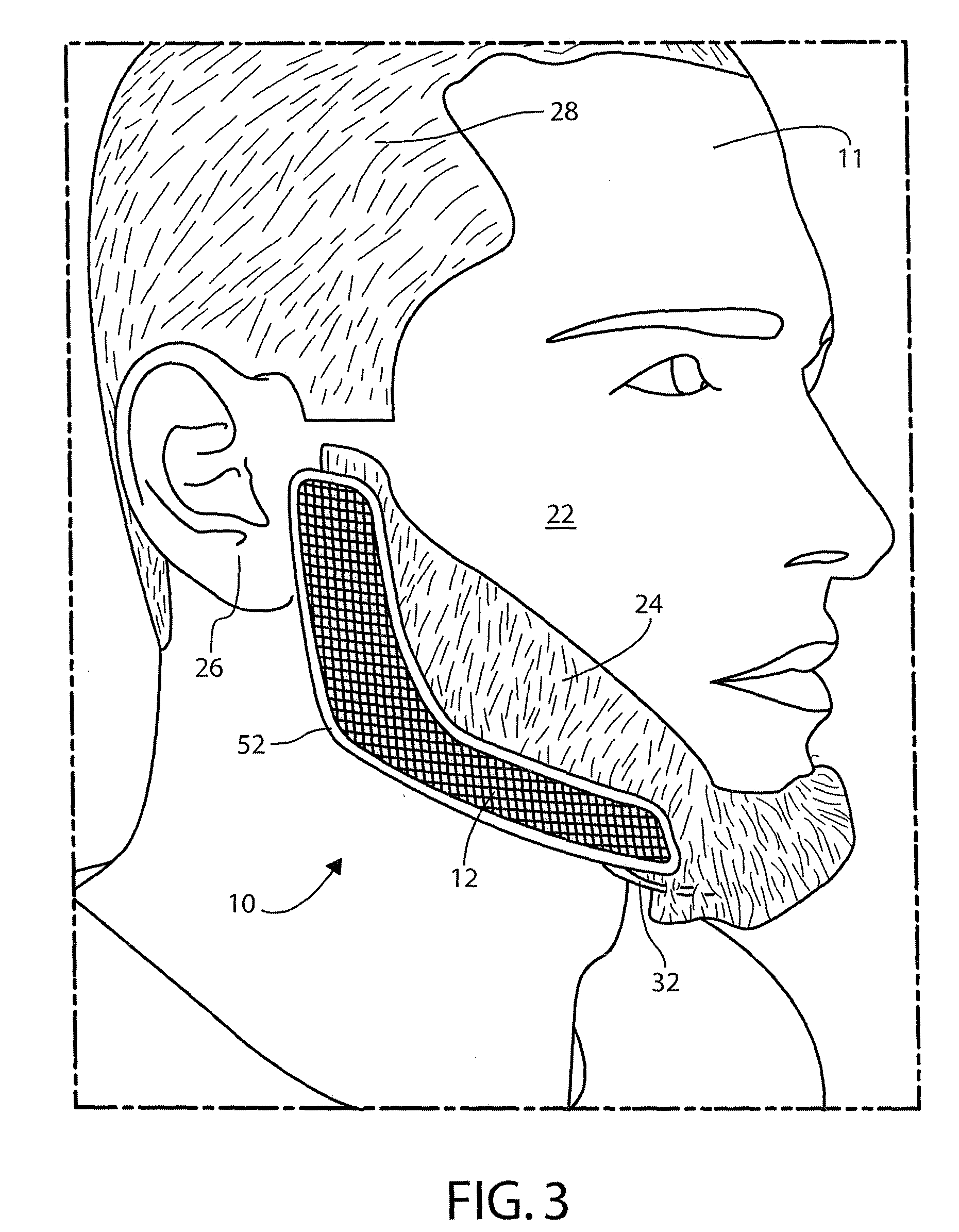 Patent Us20090223530 Facial Hair Trimming Template And Method Google Patents Printable Beard Shaping Template