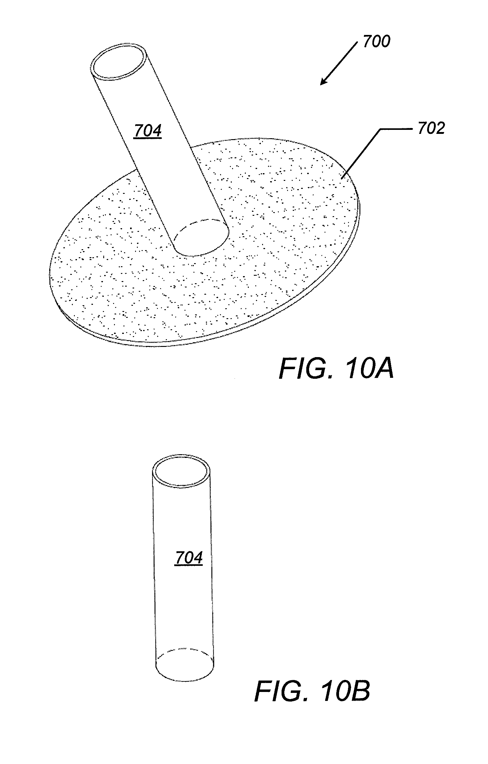 Define patent anus not Can discussed Define patent anus