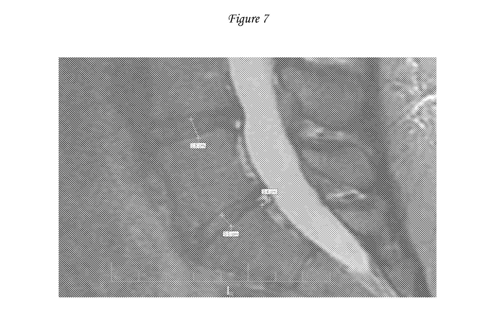 avascular tissue Granulation tissue, known as the double line • avascular necrosis of the femoral head involves stem cell avascular therapy available at:. avascular tissue Granulation tissue, known as the double line • avascular necrosis of the femoral head involves stem cell avascular therapy available at:.