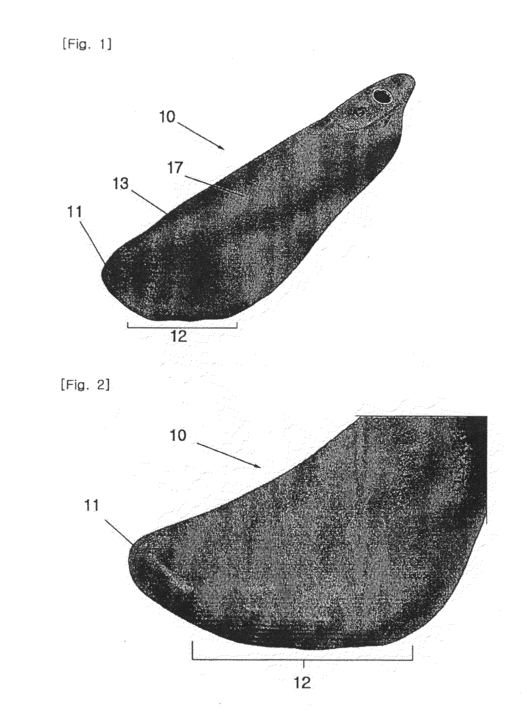 Morton neuroma