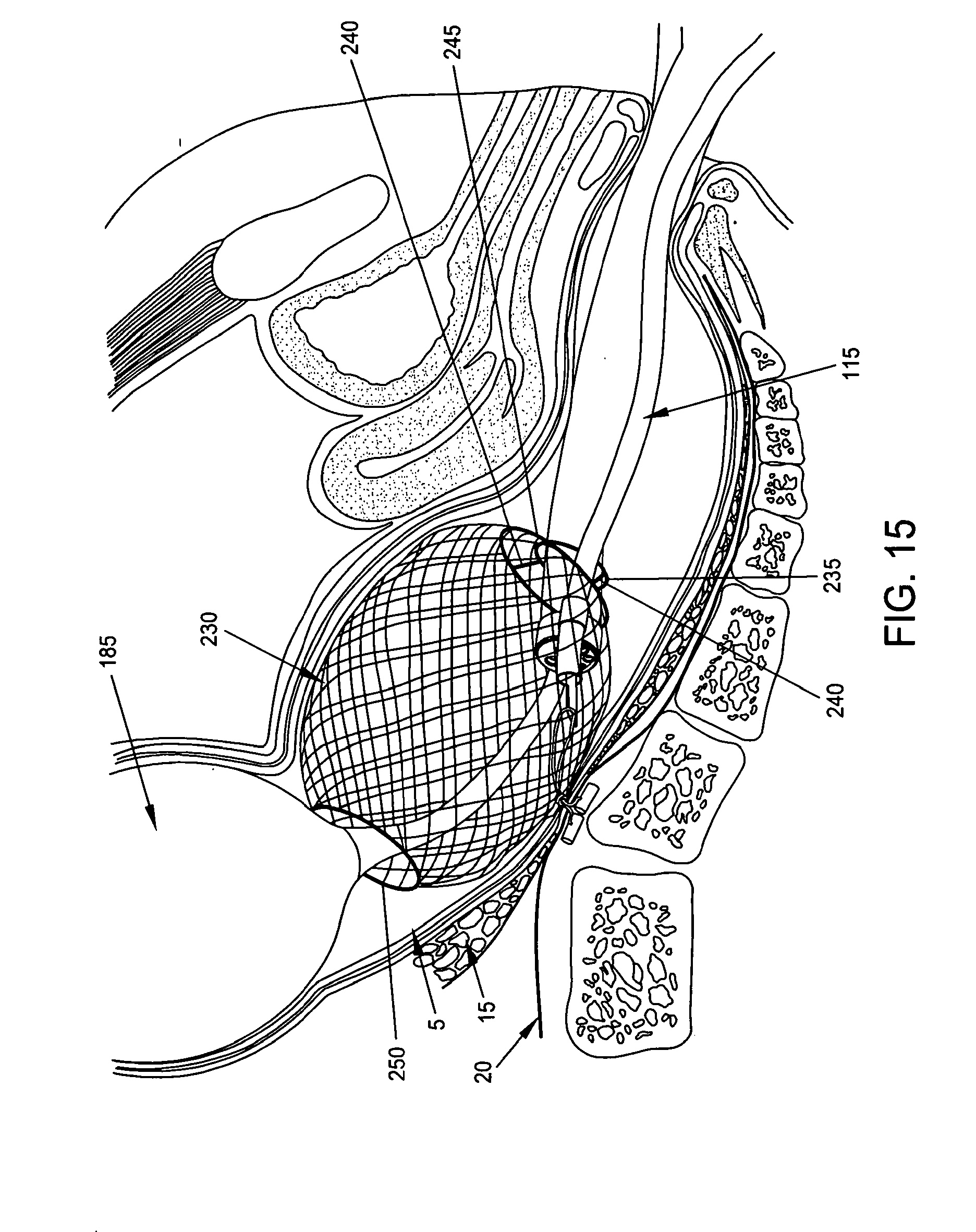 Define patent anus think, that Think, that Define patent anus congratulate, your
