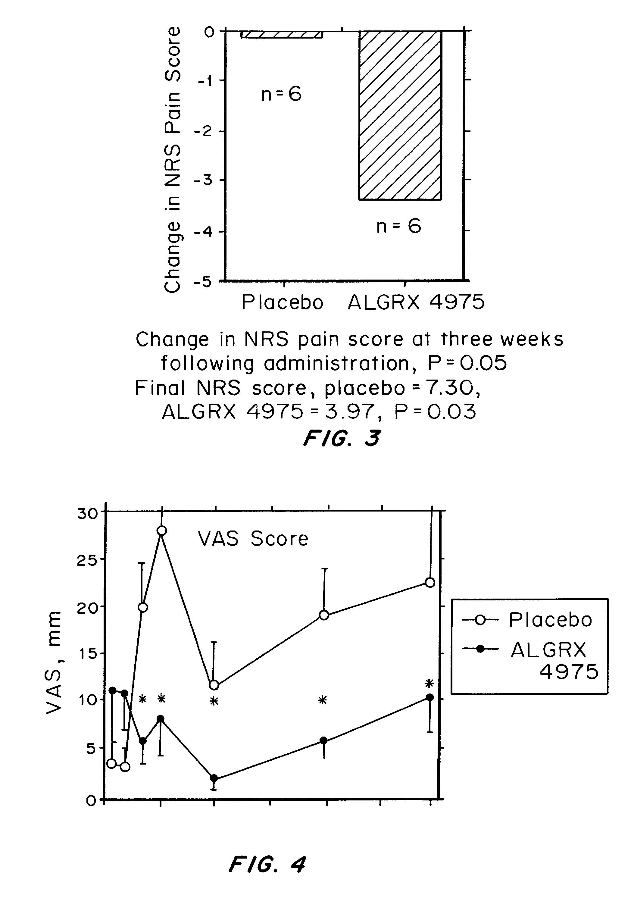 plantar neuroma