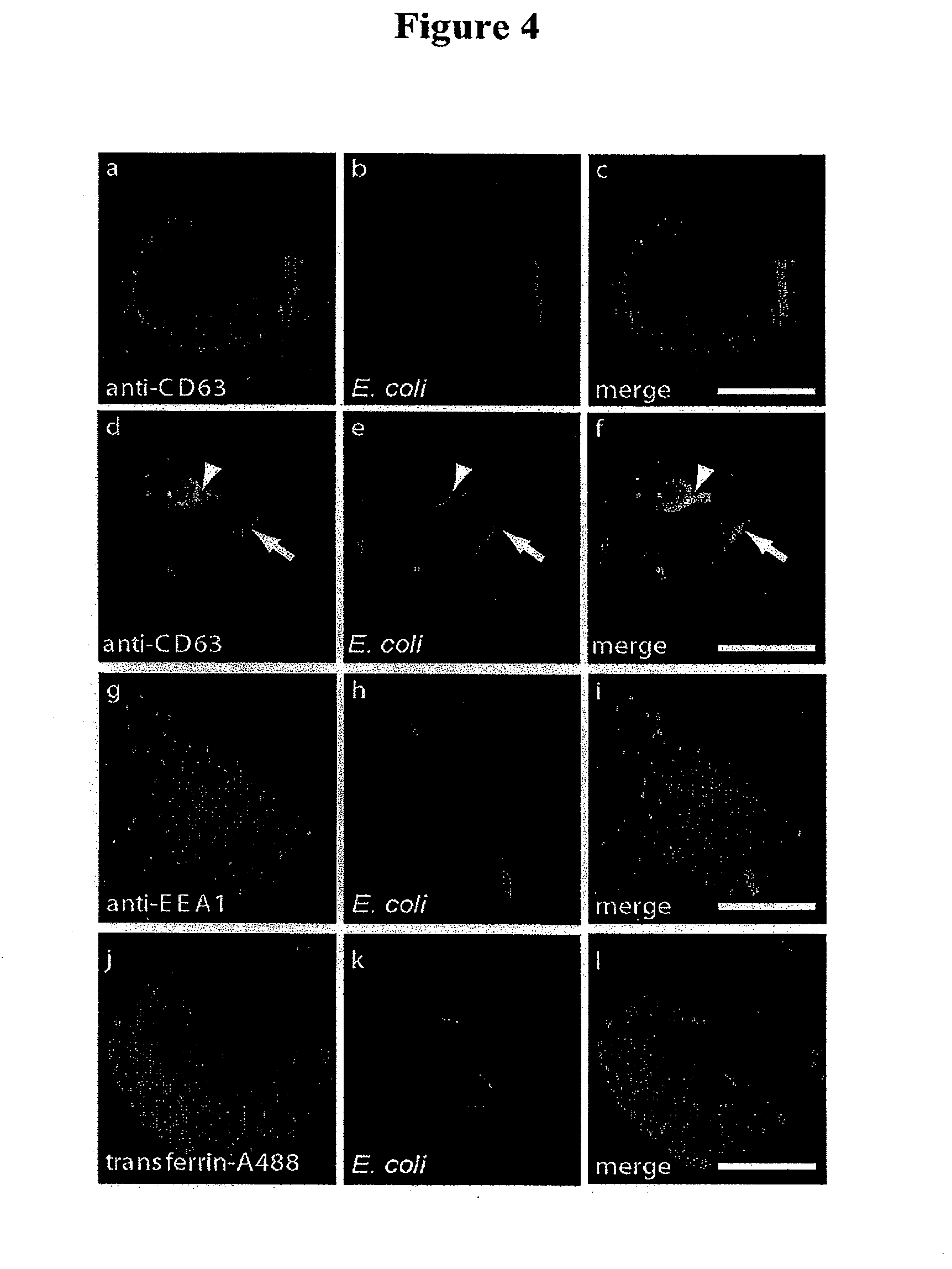 Phenobarbitone Injection (DBL) myVMC Leg Pain and Swelling From Ciprofloxacin - Side Effects Site