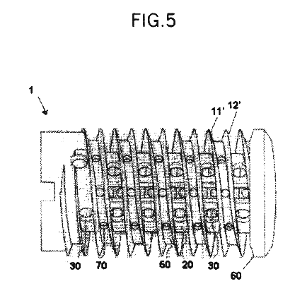 spinal prothesis brantigan cages The introduction of titanium cages for the purpose of spinal “fusion” opened an important new era in spine stabilization not only have titanium cages, when. spinal prothesis brantigan cages The introduction of titanium cages for the purpose of spinal “fusion” opened an important new era in spine stabilization not only have titanium cages, when.