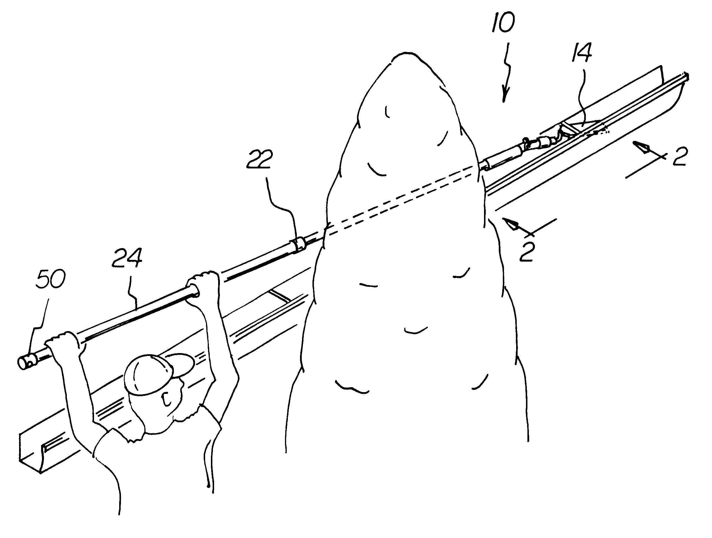 gutter cleaning system by www.google.com gutter cleaning system