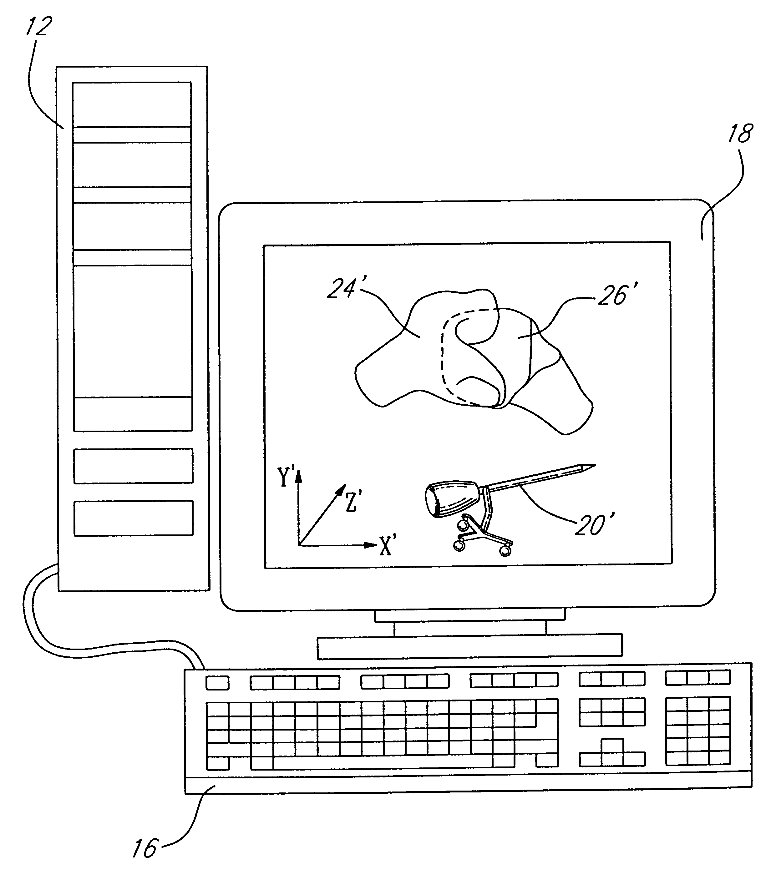 Computer assisted trading system