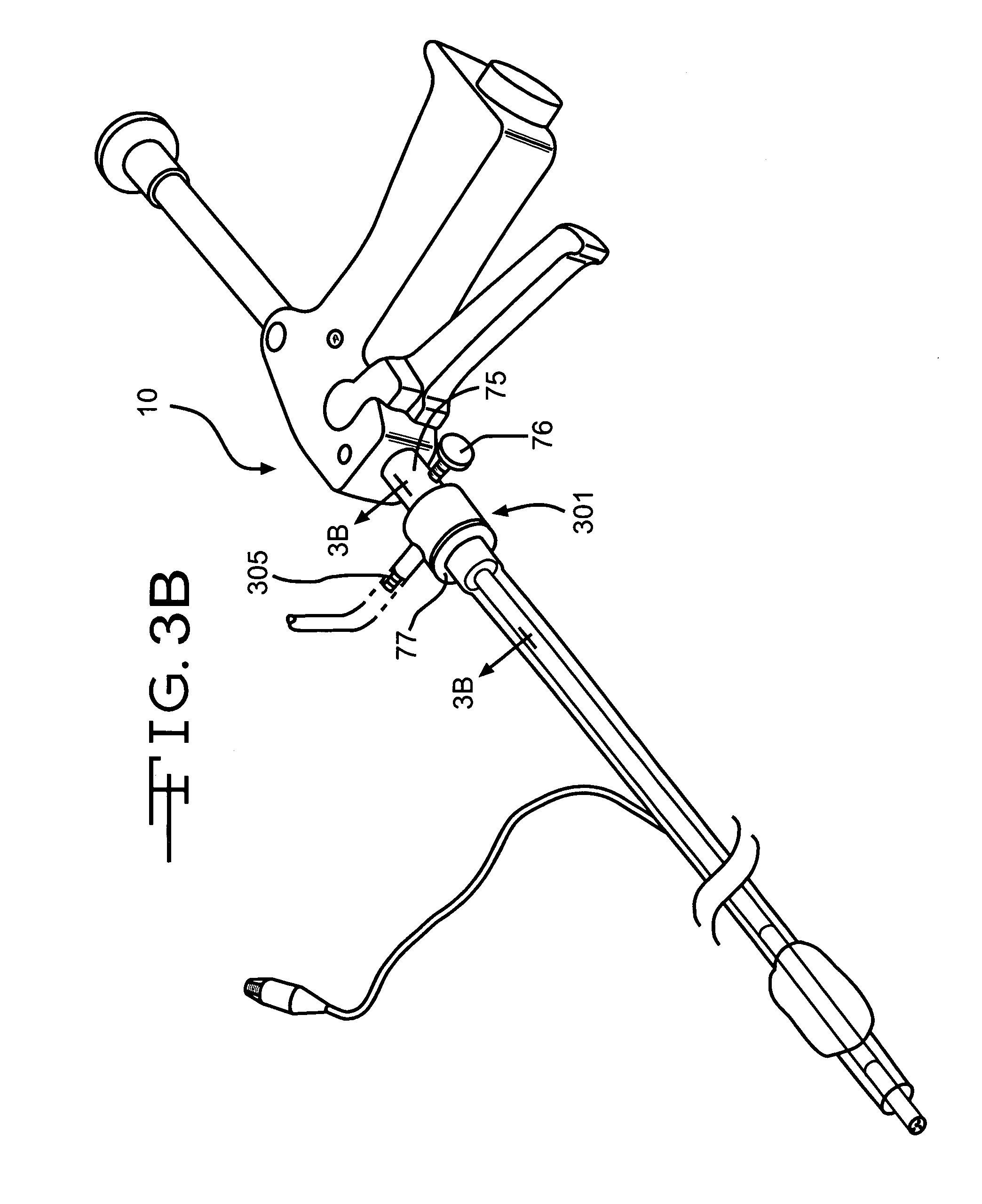 endotracheal intubation Bed at comfortable height for laryngoscopist patient aligned without lateral deviation of head or neck shoulders and/or neck supported with rolls or pillows to allow positioning of head neck flexed approx 15 degrees on chest head hyperextended on neck to maximum comfortable degree (may be best done . endotracheal intubation Bed at comfortable height for laryngoscopist patient aligned without lateral deviation of head or neck shoulders and/or neck supported with rolls or pillows to allow positioning of head neck flexed approx 15 degrees on chest head hyperextended on neck to maximum comfortable degree (may be best done .