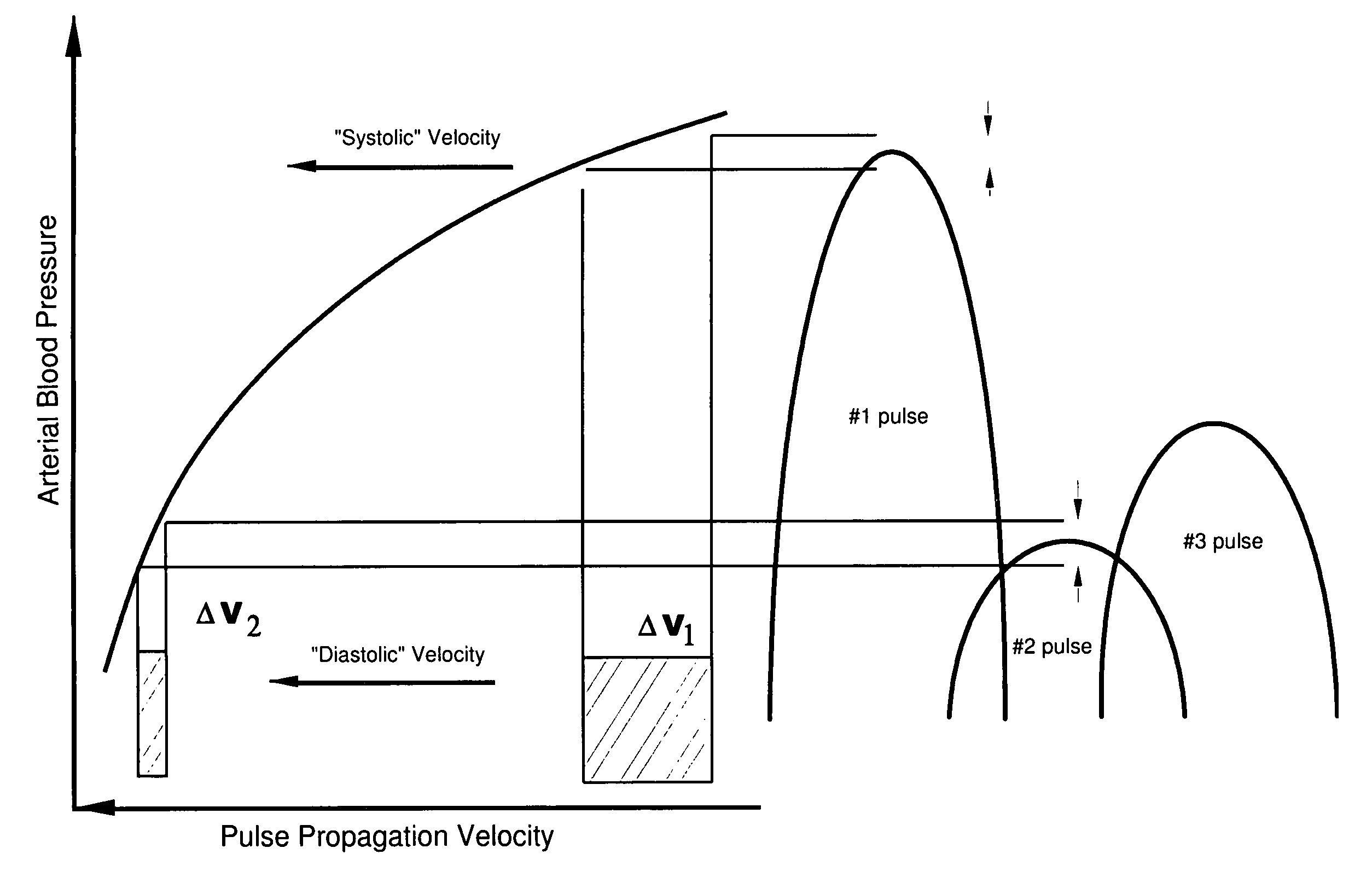 an analysis of the method of measuring arterial blood pressure Comparison of continuous arterial pressure waveform analysis with the the 2 methods for measuring co uous relationship between arterial pressure and blood. an analysis of the method of measuring arterial blood pressure Comparison of continuous arterial pressure waveform analysis with the the 2 methods for measuring co uous relationship between arterial pressure and blood.
