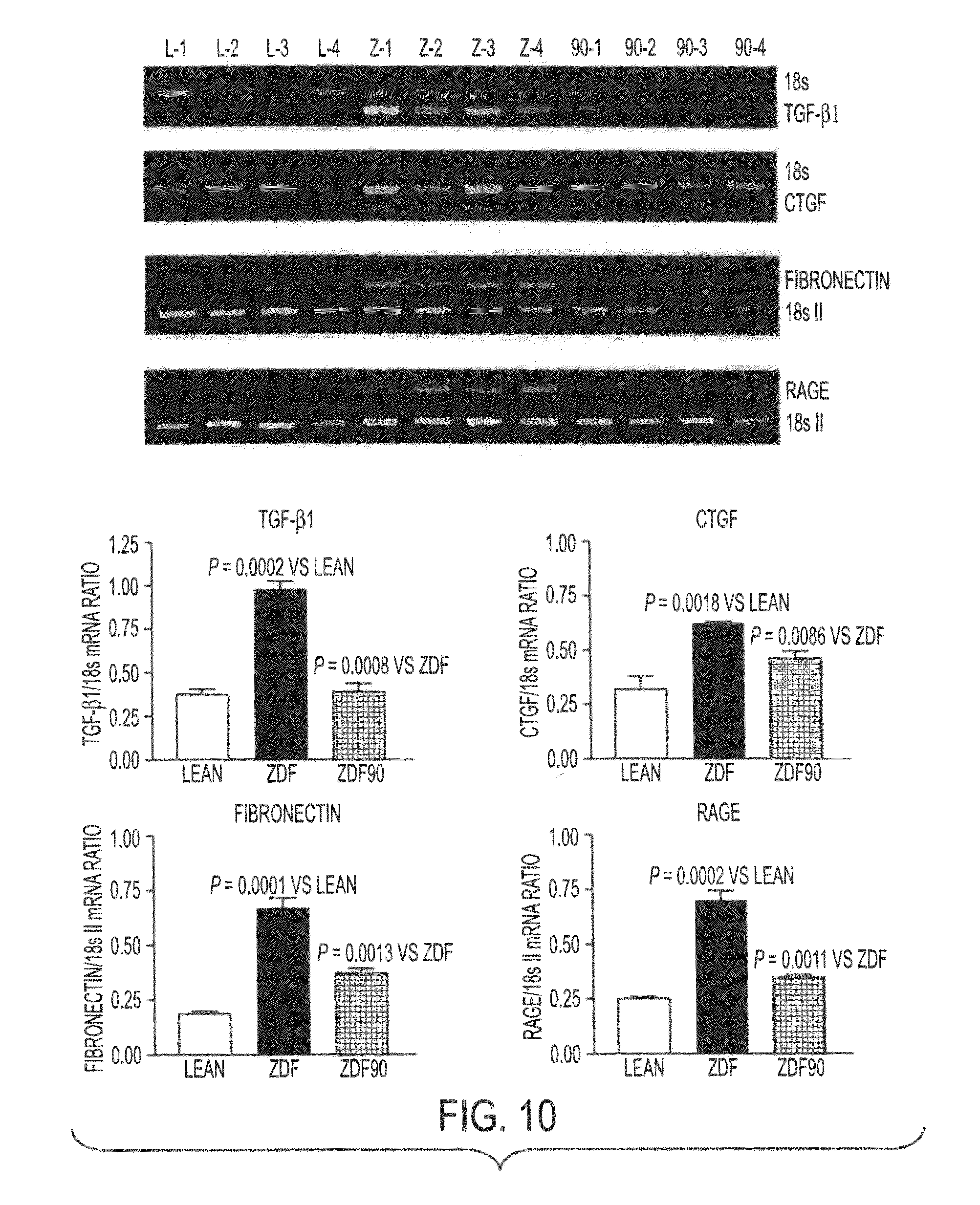 overcoming insulin resistance 1 nat med 2006 may12(5):511-2 overcoming insulin resistance with cntf ahima rs comment on nat med 2006 may12(5):541-8 pmid: 16675997. overcoming insulin resistance 1 nat med 2006 may12(5):511-2 overcoming insulin resistance with cntf ahima rs comment on nat med 2006 may12(5):541-8 pmid: 16675997.