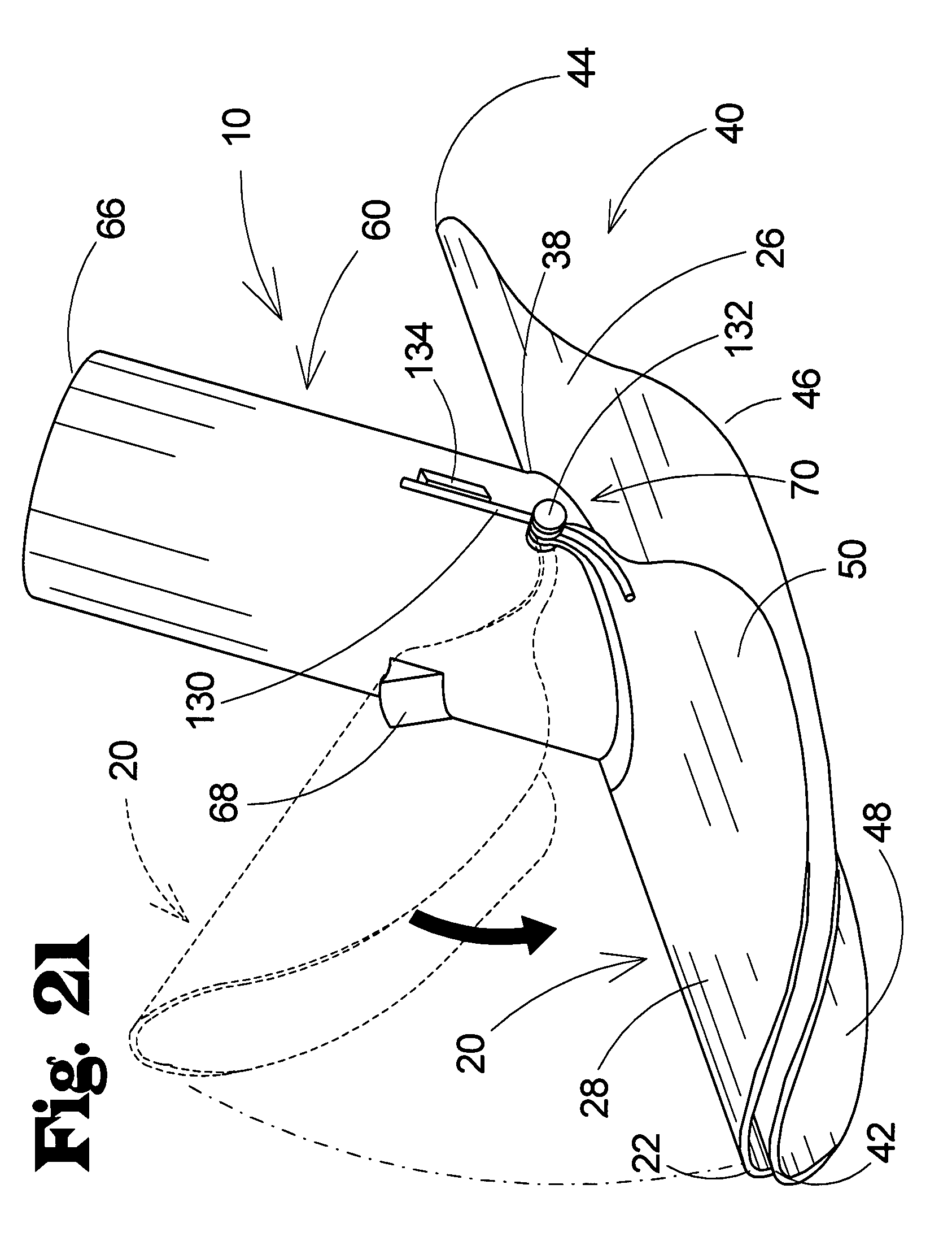 vascular anastomosis