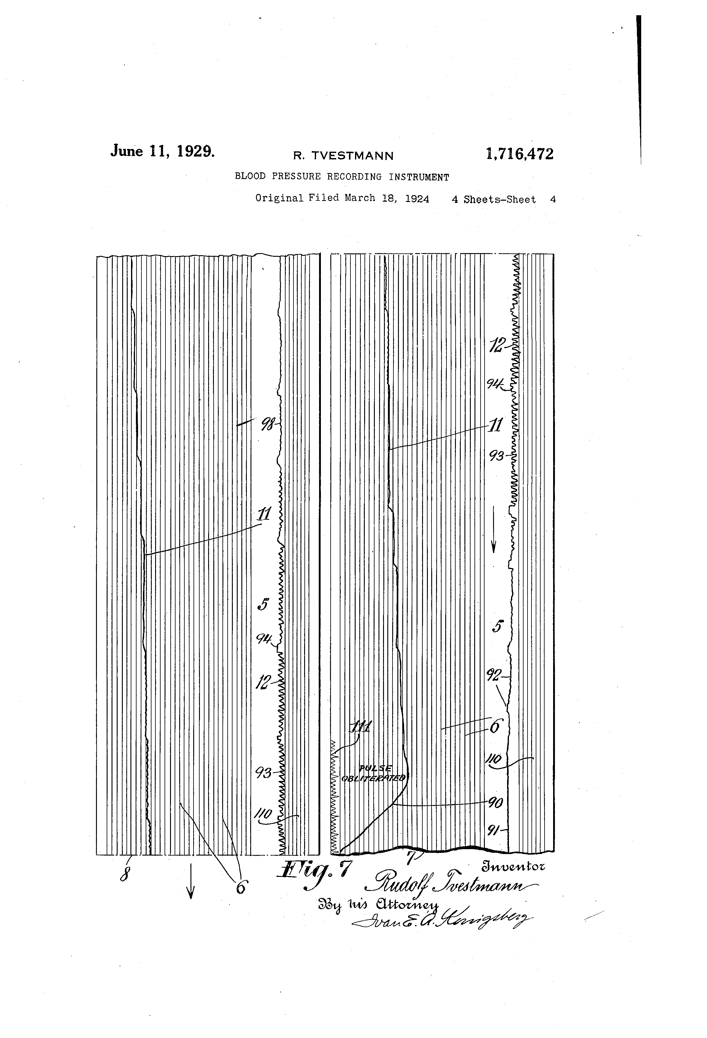 blood pressure recording sheets
