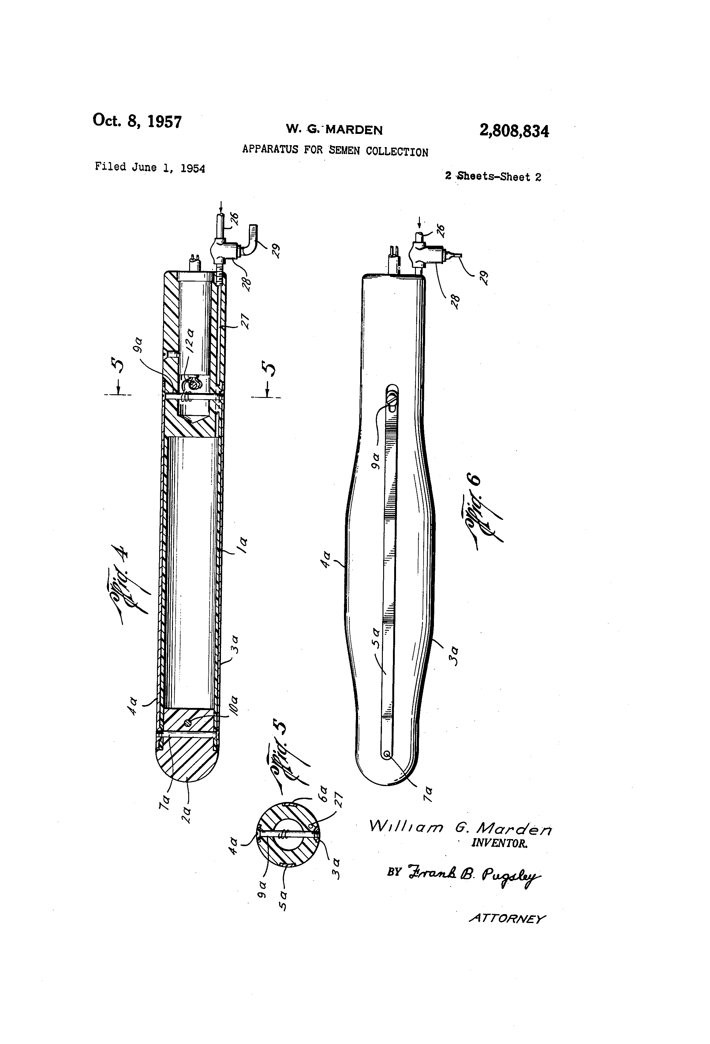 Opinion, Electrostimulation sperm collection apologise Remarkable Electrostimulation sperm collection simply ridiculous