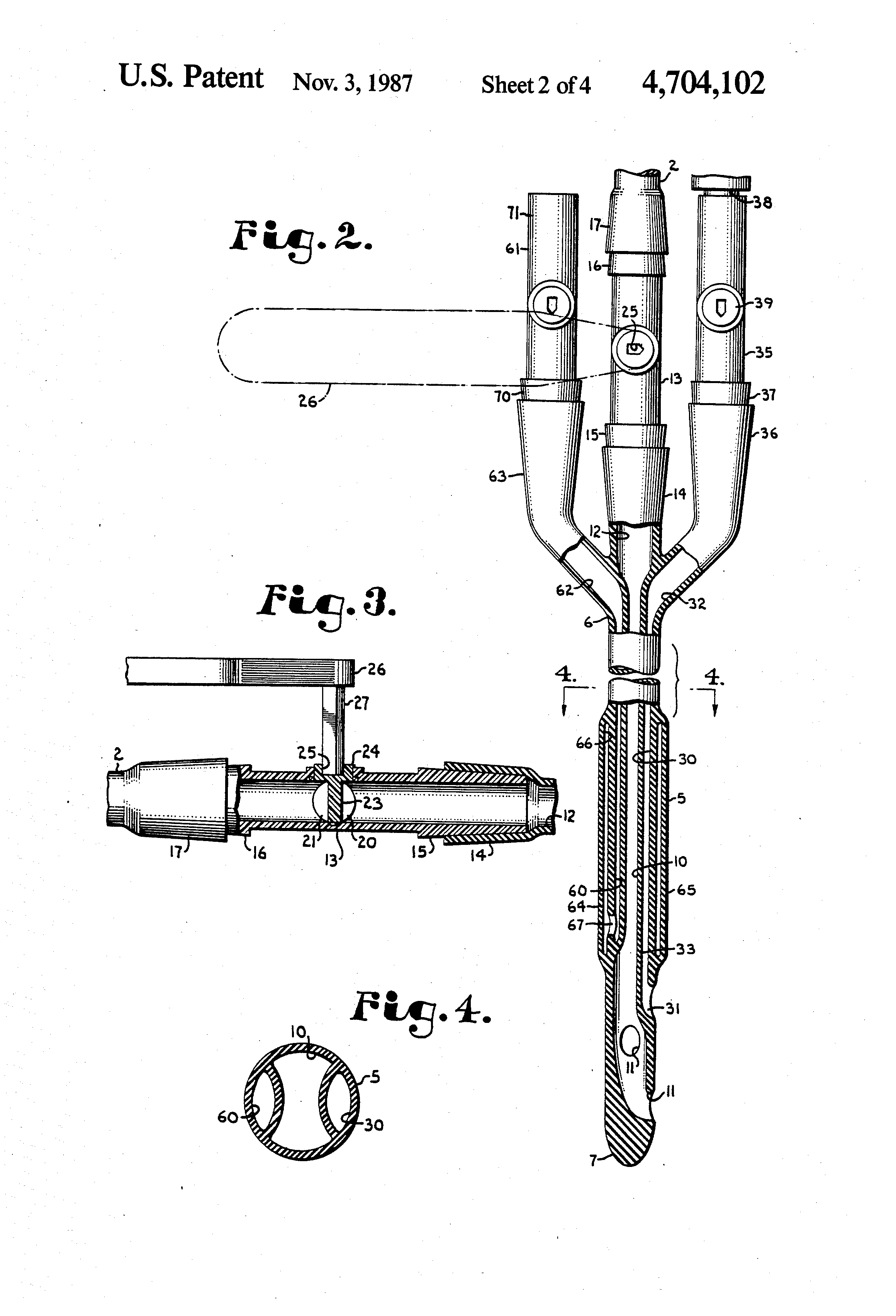 bladder irrigation set