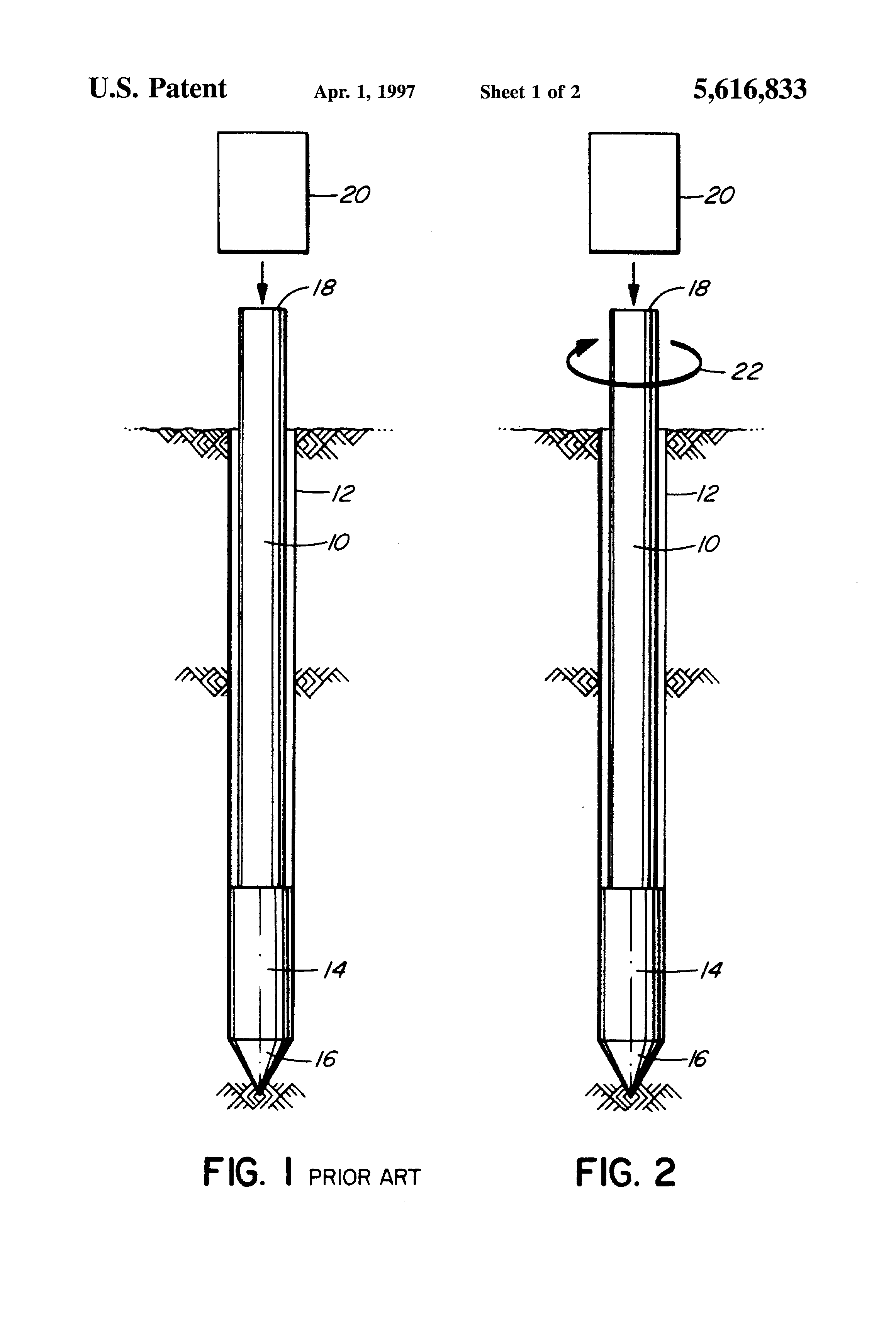 Redtube ass fetish Anal sphincter tone