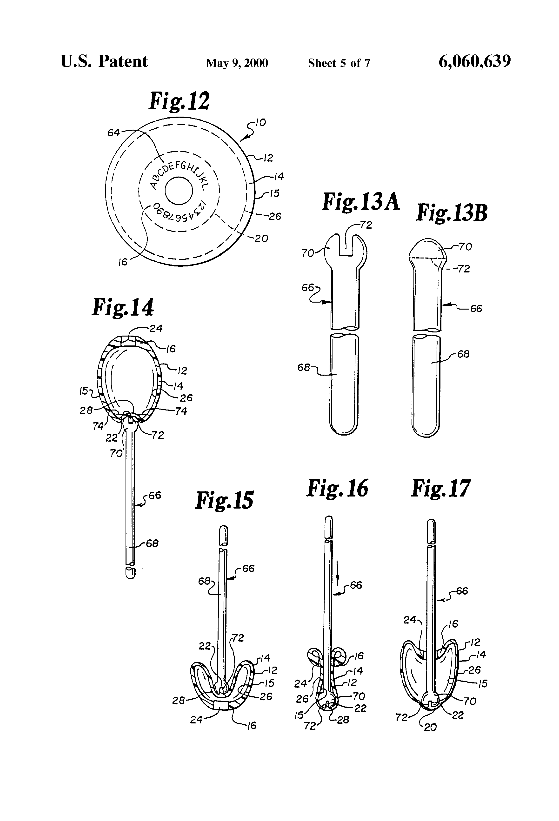 silicone testicular prothesis silicone testicular prothesis