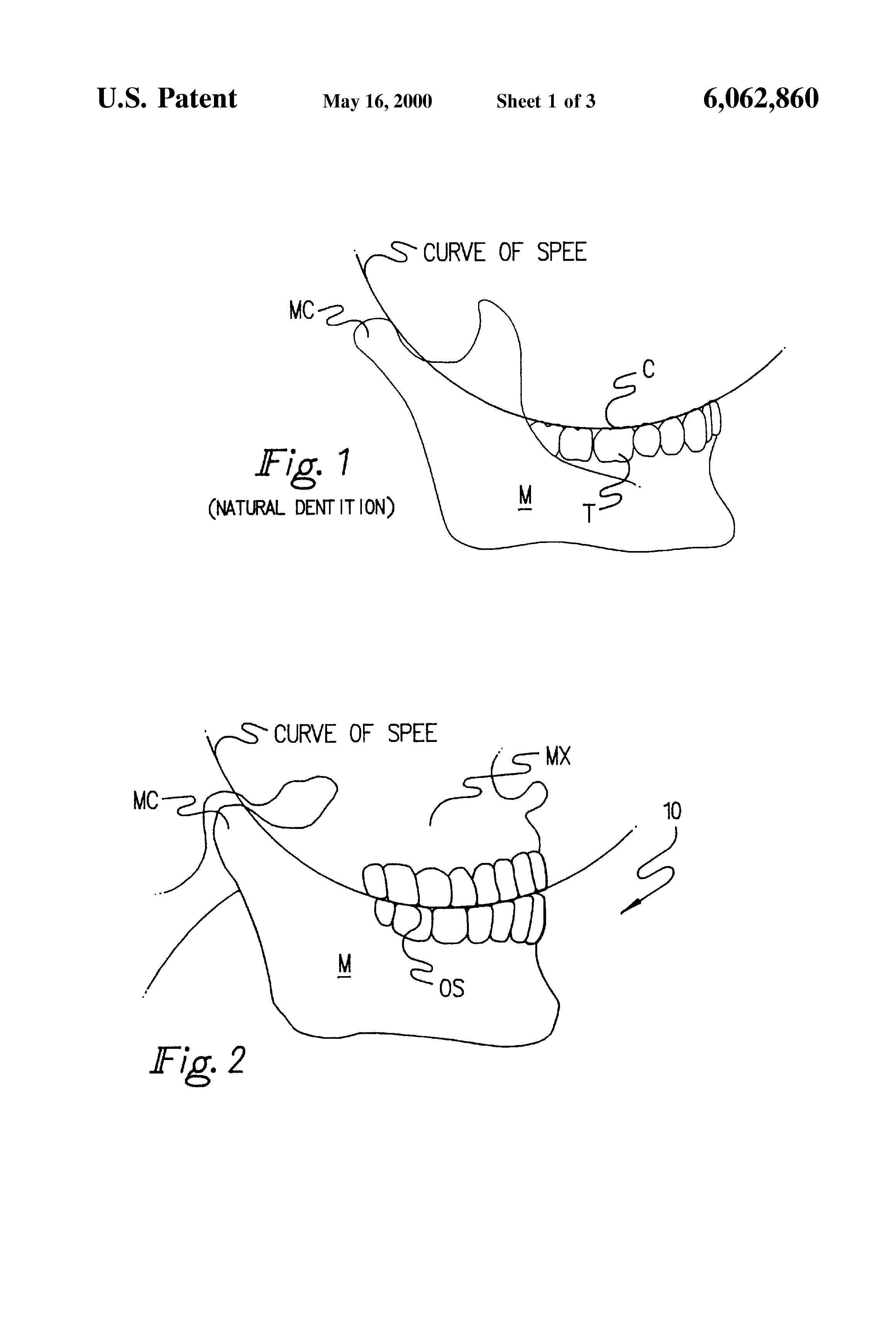curve of spee