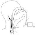 Patent Drawing