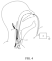 Patent Drawing