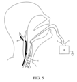 Patent Drawing