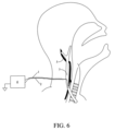 Patent Drawing
