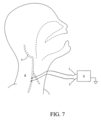 Patent Drawing