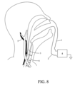 Patent Drawing