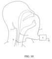 Patent Drawing