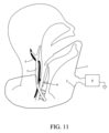 Patent Drawing