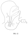 Patent Drawing