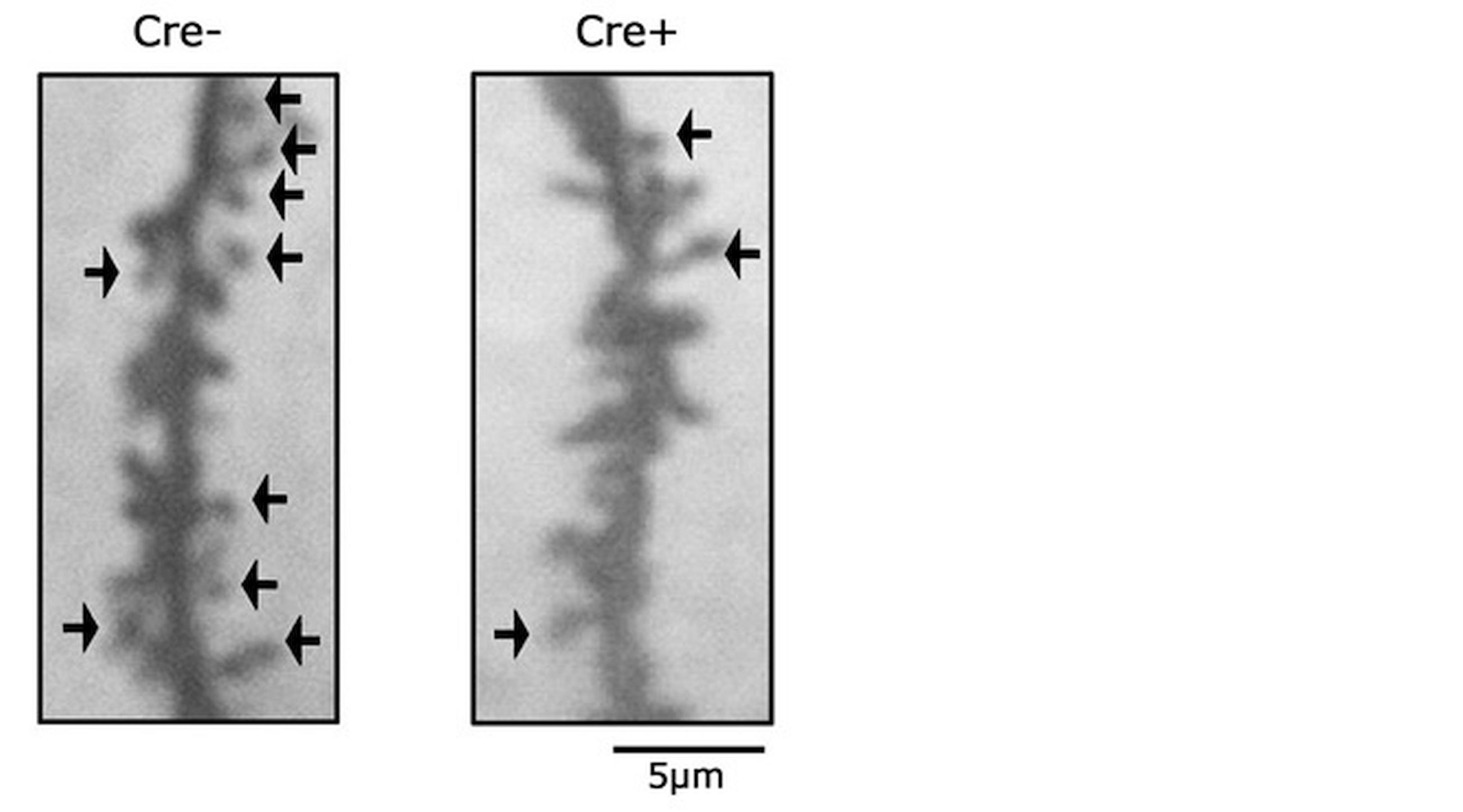 WO2018012497A1 - 疾患モデル動物および疾患治療剤 - Google Patents