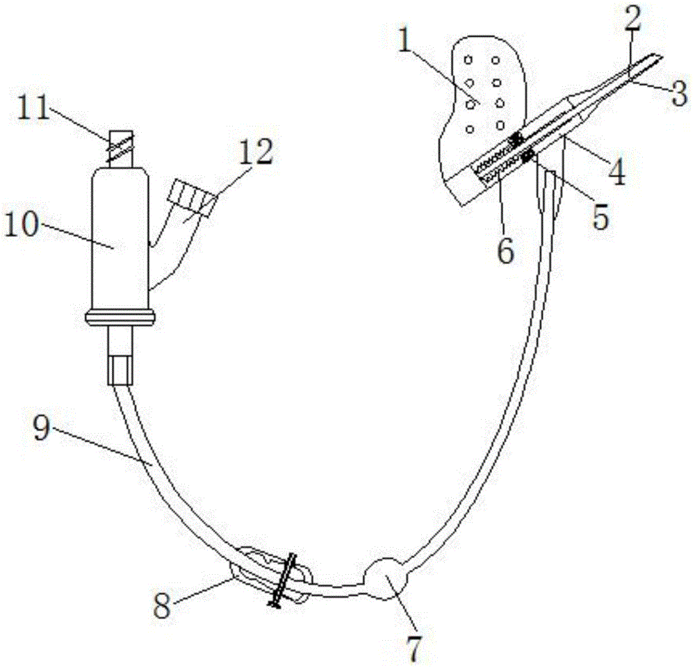 Figure 201821428770
