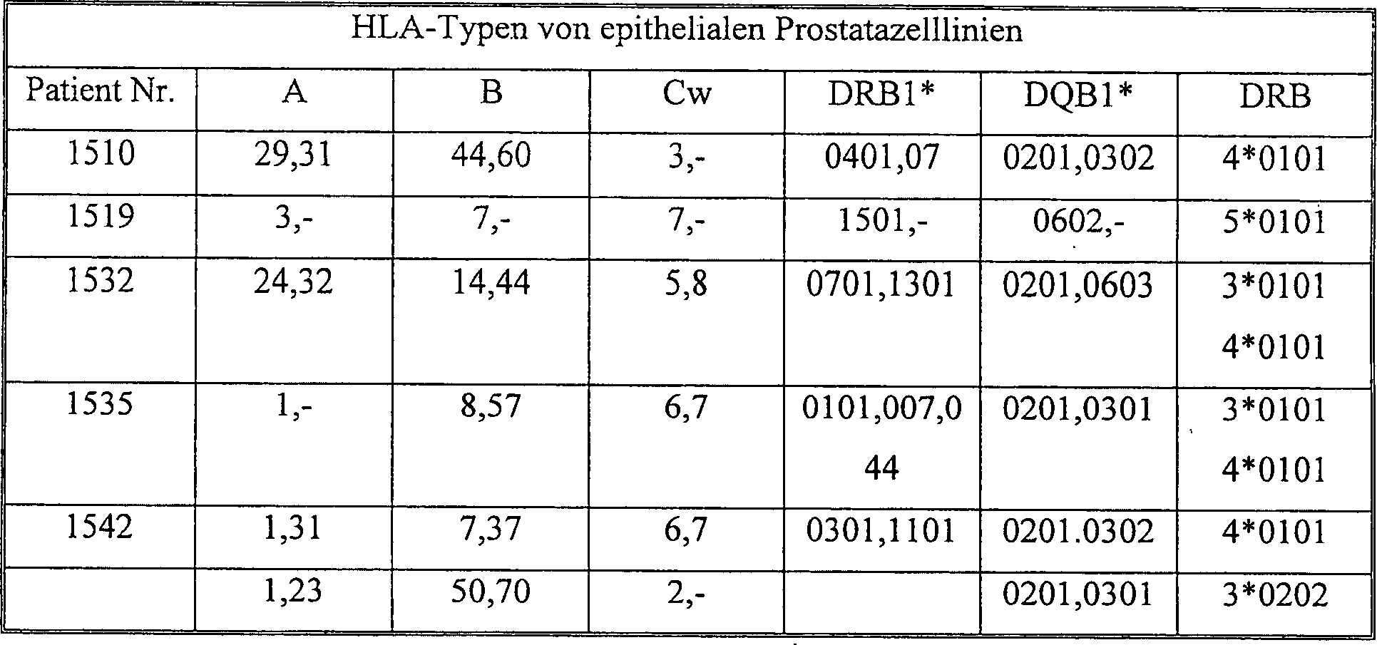 tumore prostata gleason 4+ 3 tumore prostata gleason 4+ 3