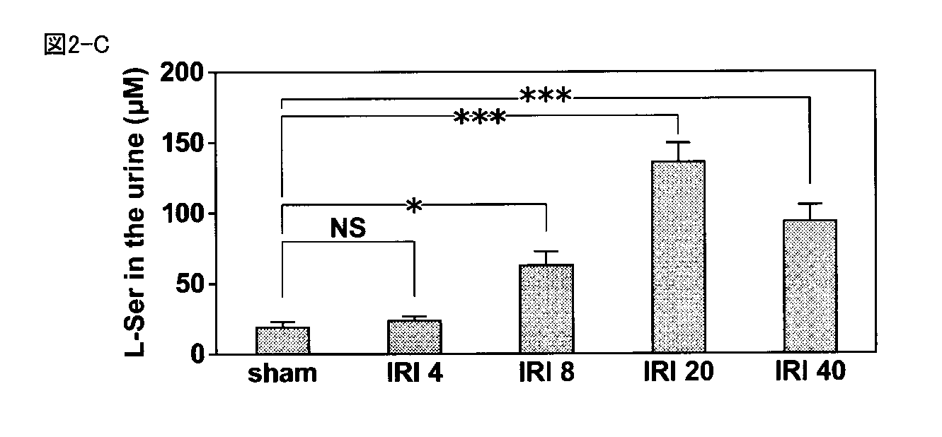 Wo2015087985a1 Marker For Early Diagnosis Of Kidney Failure Google Patents