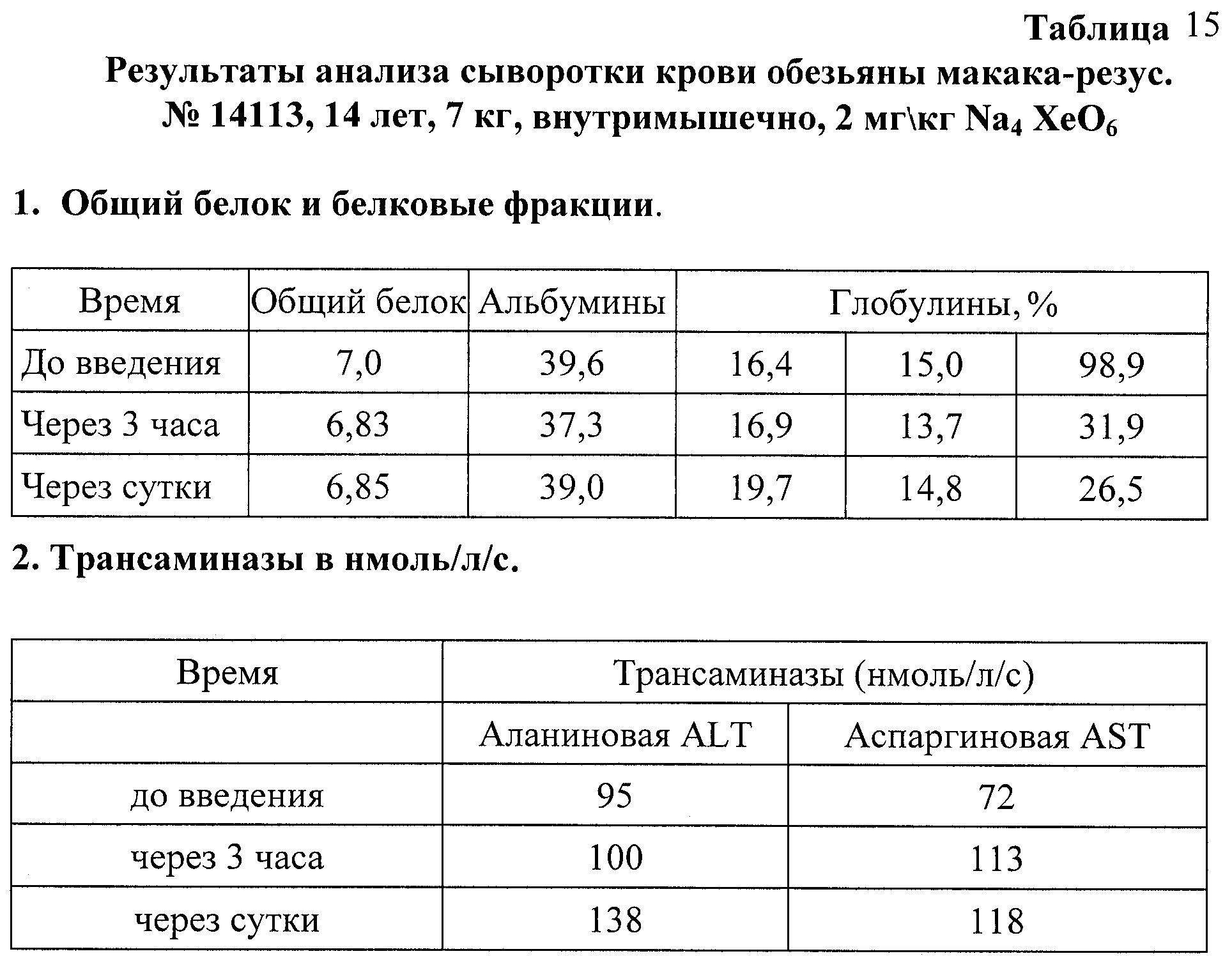 Figure 00000017