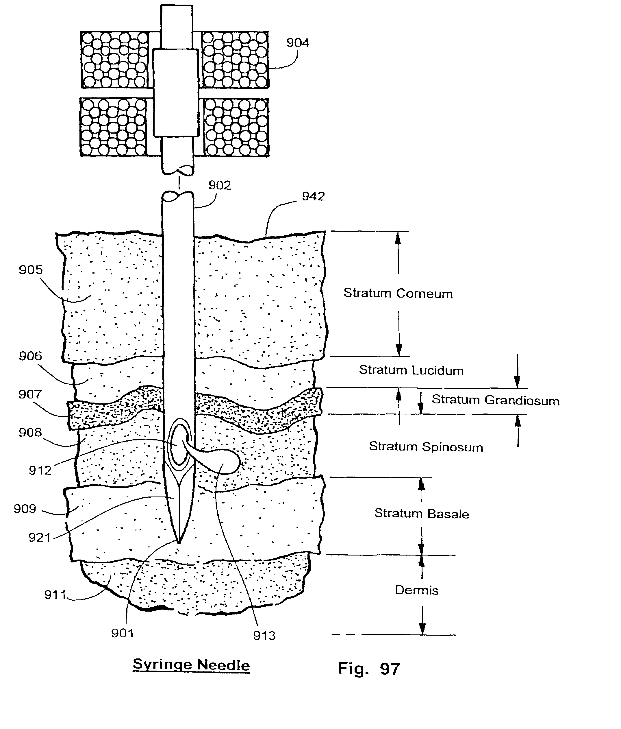 us8206319b2 tissue penetration device google patents to pass a dd form 626 inspection the driver must provide