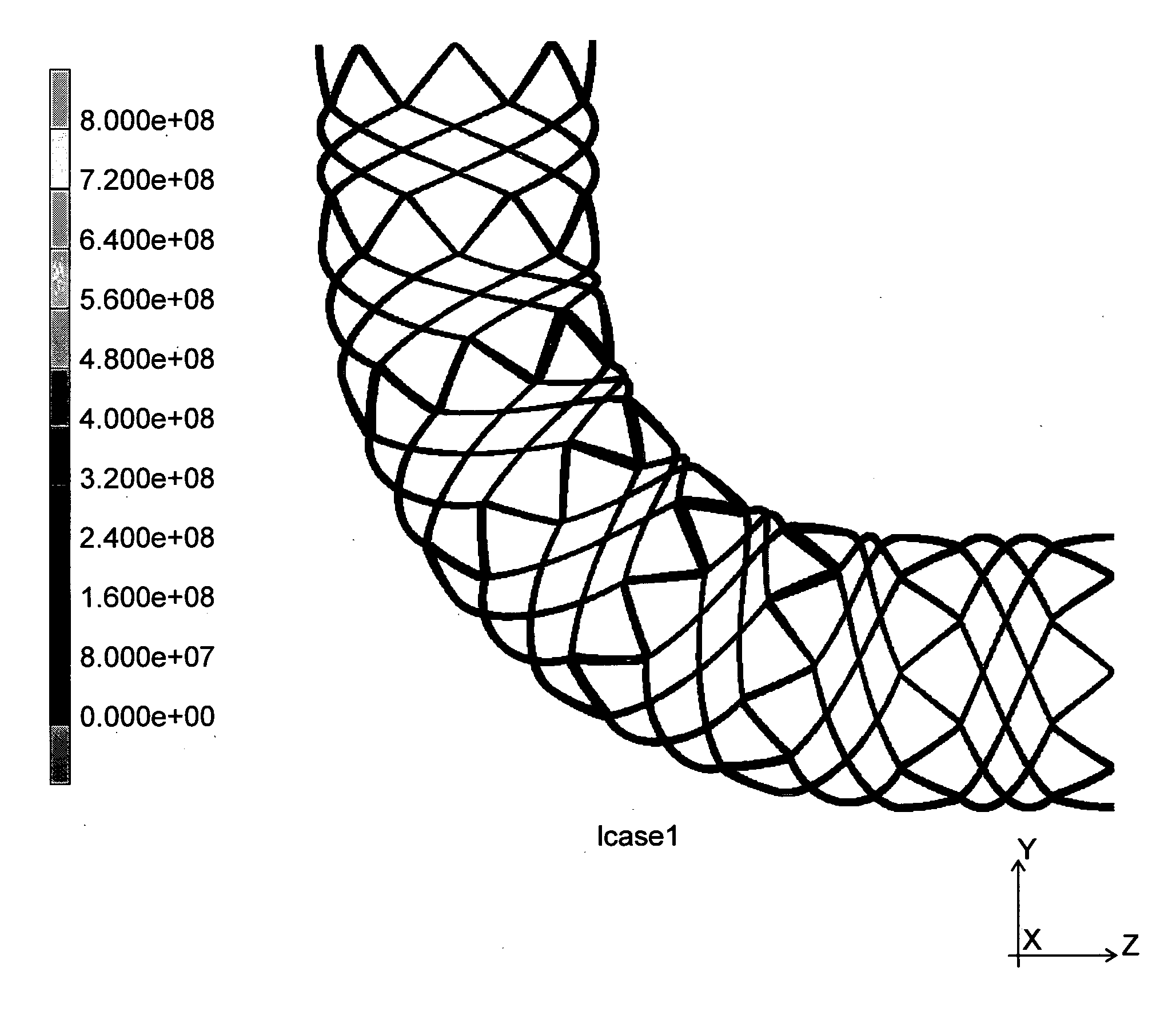 Woa1 生体の管状器官に使用するステント Google Patents