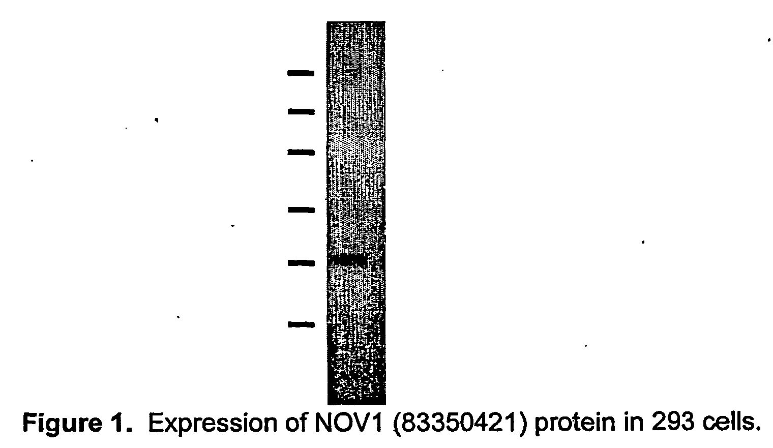 Figure 01250001