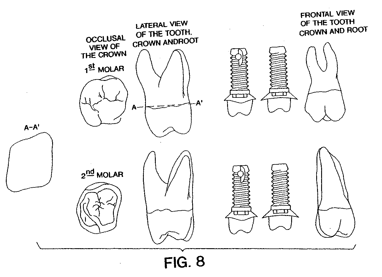 Figure 00000001