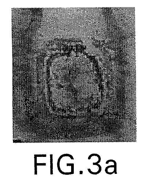 Figure 00000003