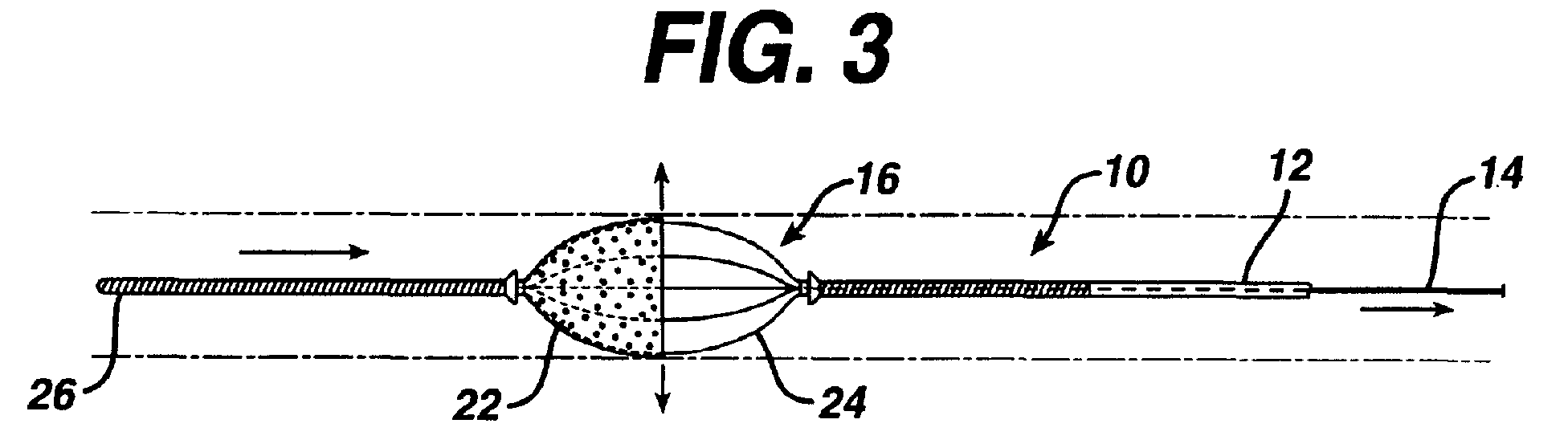 Figure 00000001