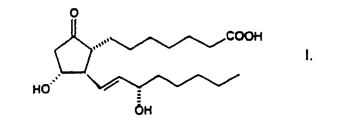 Figure 00060001